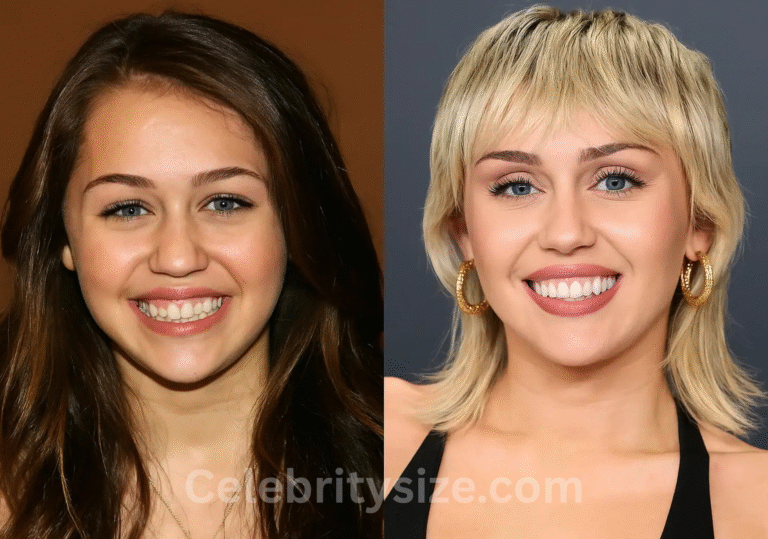 Miley Cyrus Teeth
