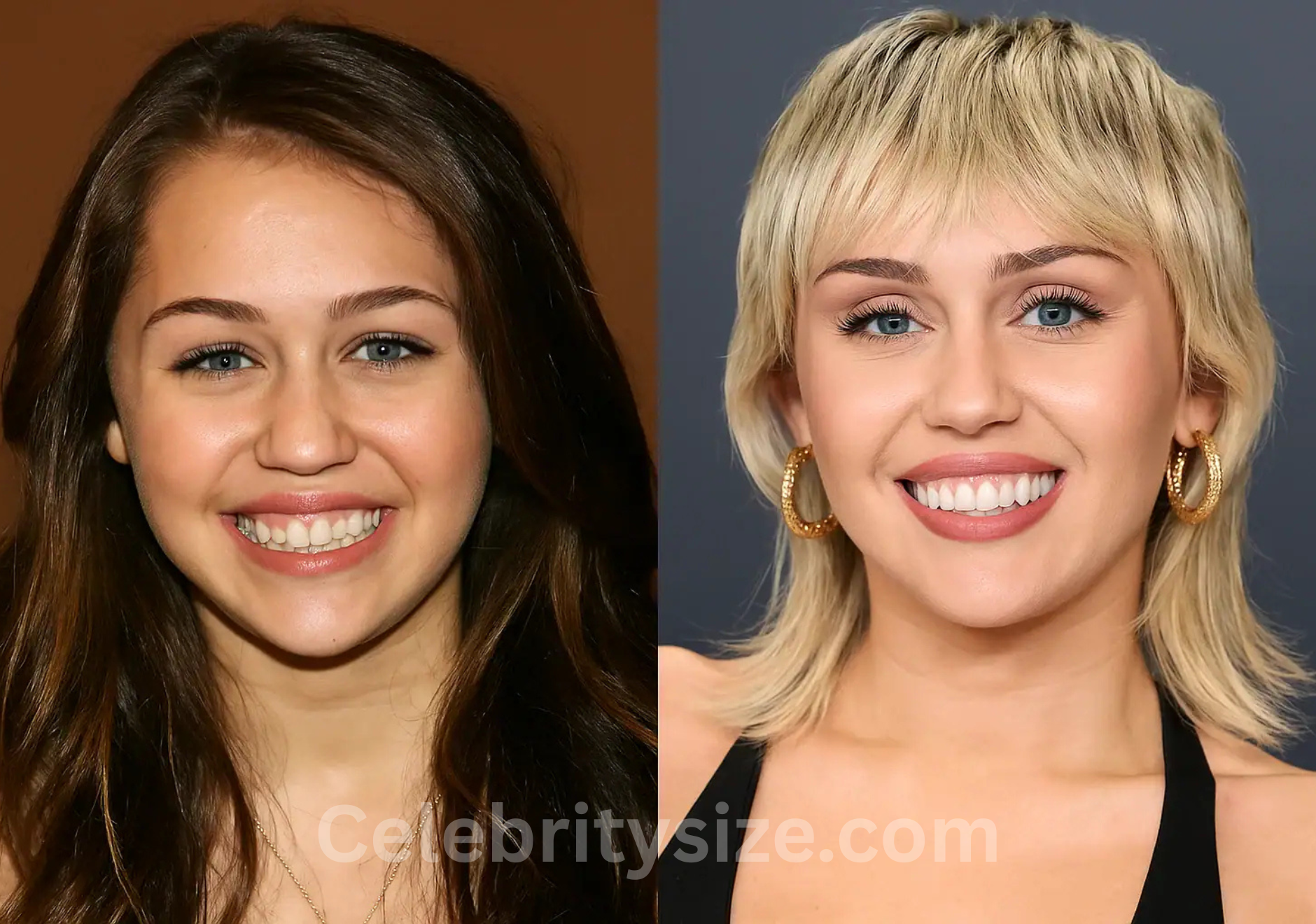 Miley Cyrus Teeth